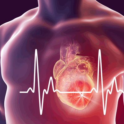 Cardiovascular Diseases: Our Guide to Prevention Through Precision Nutrition